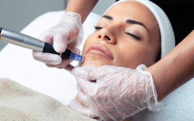 The Nano-Needle Facial: A Revolution in Skin Rejuvenation